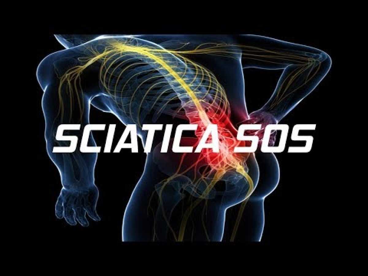 How to cure sciatica, relieve sciatic nerve pain fast [and naturally]