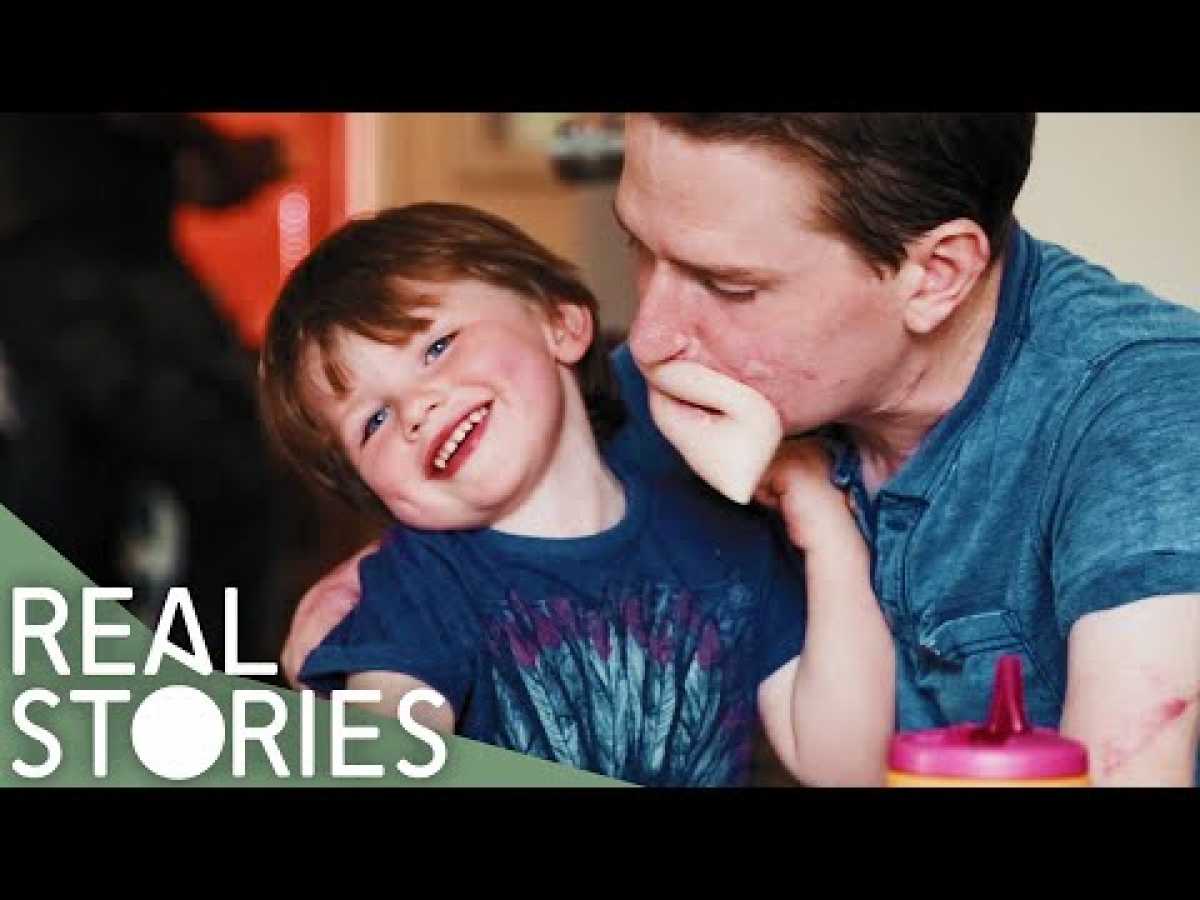 How Did Alex Lewis' Family Cope With His Illness? | Real Stories