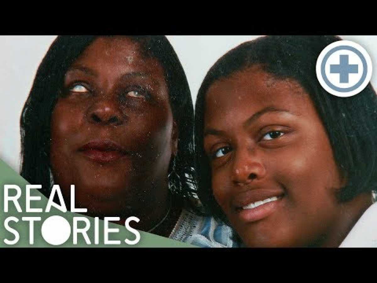 I Am My Mum's Carer (Young Caregiver Documentary) | Real Stories